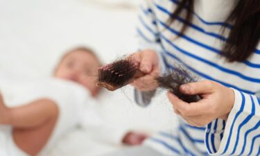 2/3 of moms report being shocked by postpartum hair loss