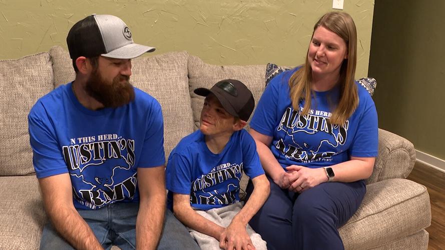 <i>KTBS via CNN Newsource</i><br/>While the procedure will not end Austin Taylor’s medical journey