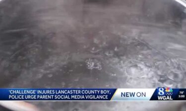 A 12-year-old boy in Lancaster Township participated in the viral "Hot Water Challenge