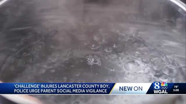 <i>WGAL via CNN Newsource</i><br/>A 12-year-old boy in Lancaster Township participated in the viral "Hot Water Challenge