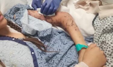San Bernardino County sheriff's detectives are investigating the mauling of a 17-year-old girl in Newberry Springs whose family members say nearly died in the attack.