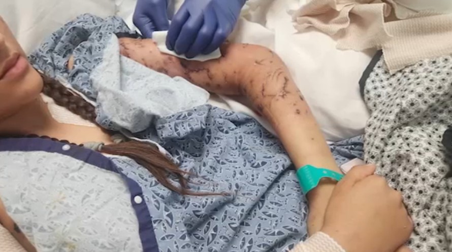 <i>KABC via CNN Newsource</i><br/>San Bernardino County sheriff's detectives are investigating the mauling of a 17-year-old girl in Newberry Springs whose family members say nearly died in the attack.