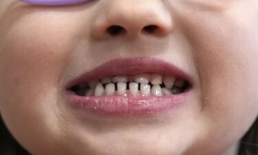 The FDA says fluoride supplements “should not be used in children under age 3 or by older children who are not at high risk of tooth decay.”