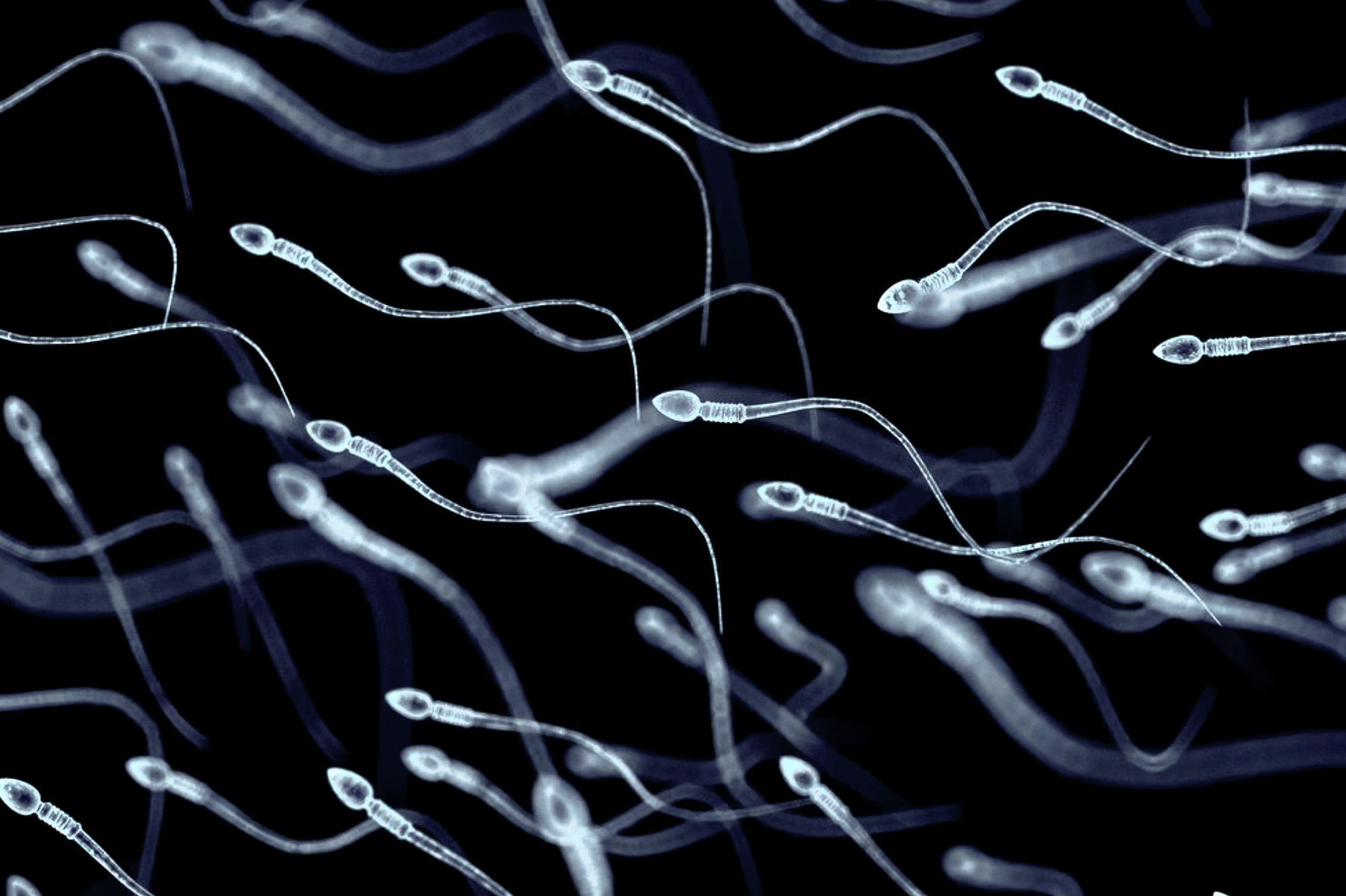 <i>LYagovy/iStockphoto/Getty Images via CNN Newsource</i><br/>A microscopic view of spermatozoa.