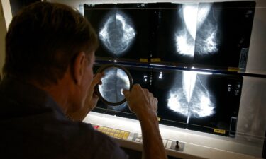 A radiologist checks mammograms in Los Angeles on May 6