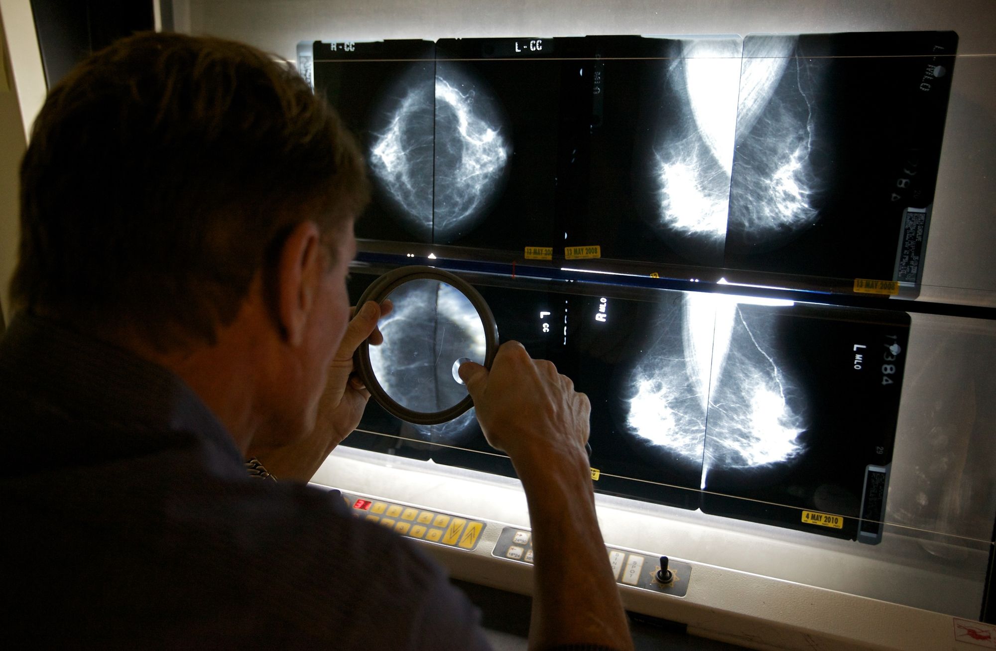 <i>Damian Dovarganes/AP/File via CNN Newsource</i><br/>A radiologist checks mammograms in Los Angeles on May 6