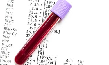 Blood tests are easier to order than ever. Doctors warn they're easy to misread.