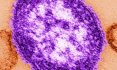 A measles virus under a microscope.