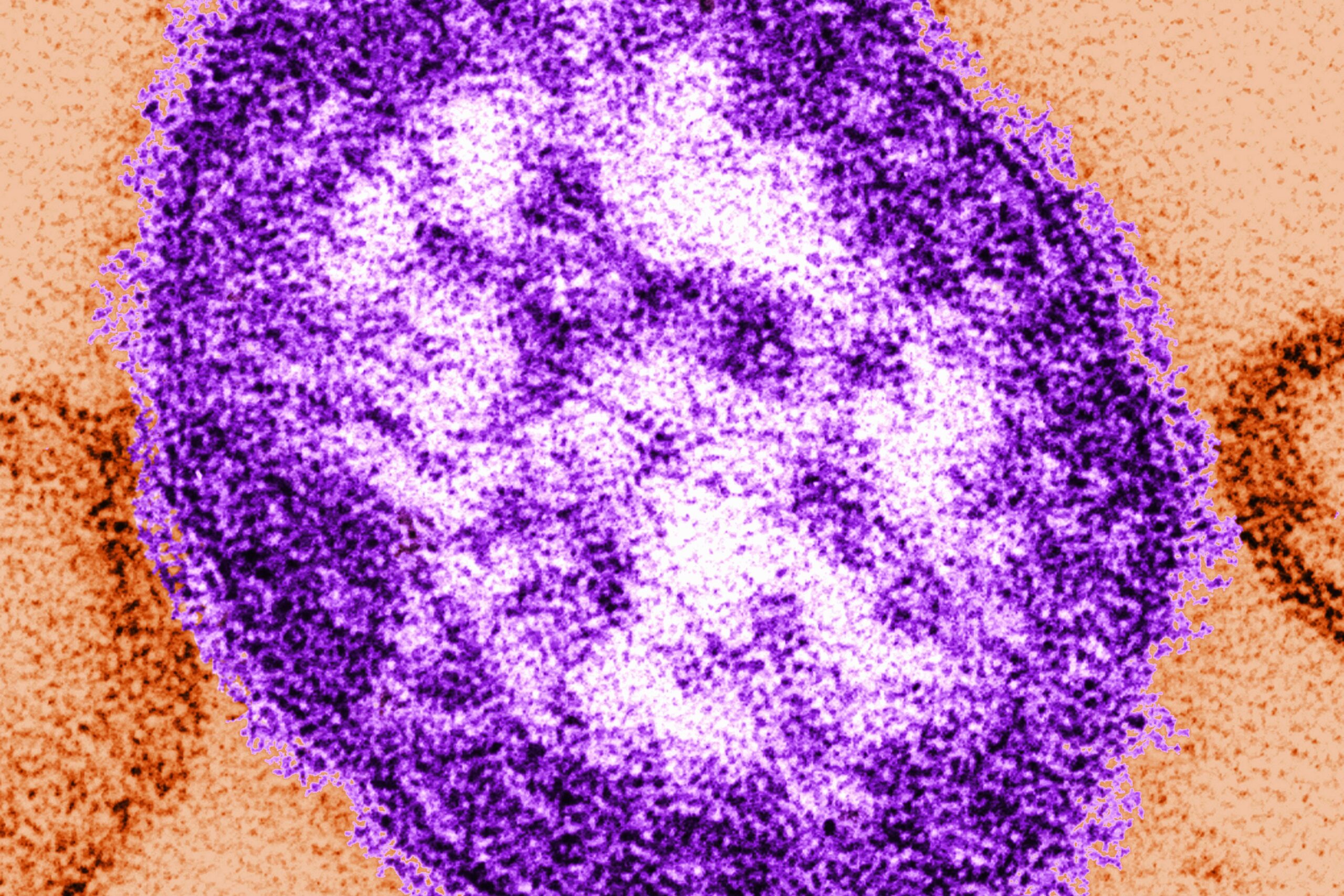 <i>Callista Images/Image Source/Getty Images via CNN Newsource</i><br/>A measles virus under a microscope.