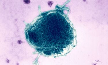 Pennsylvania has reported four deaths related to measles in 2026.