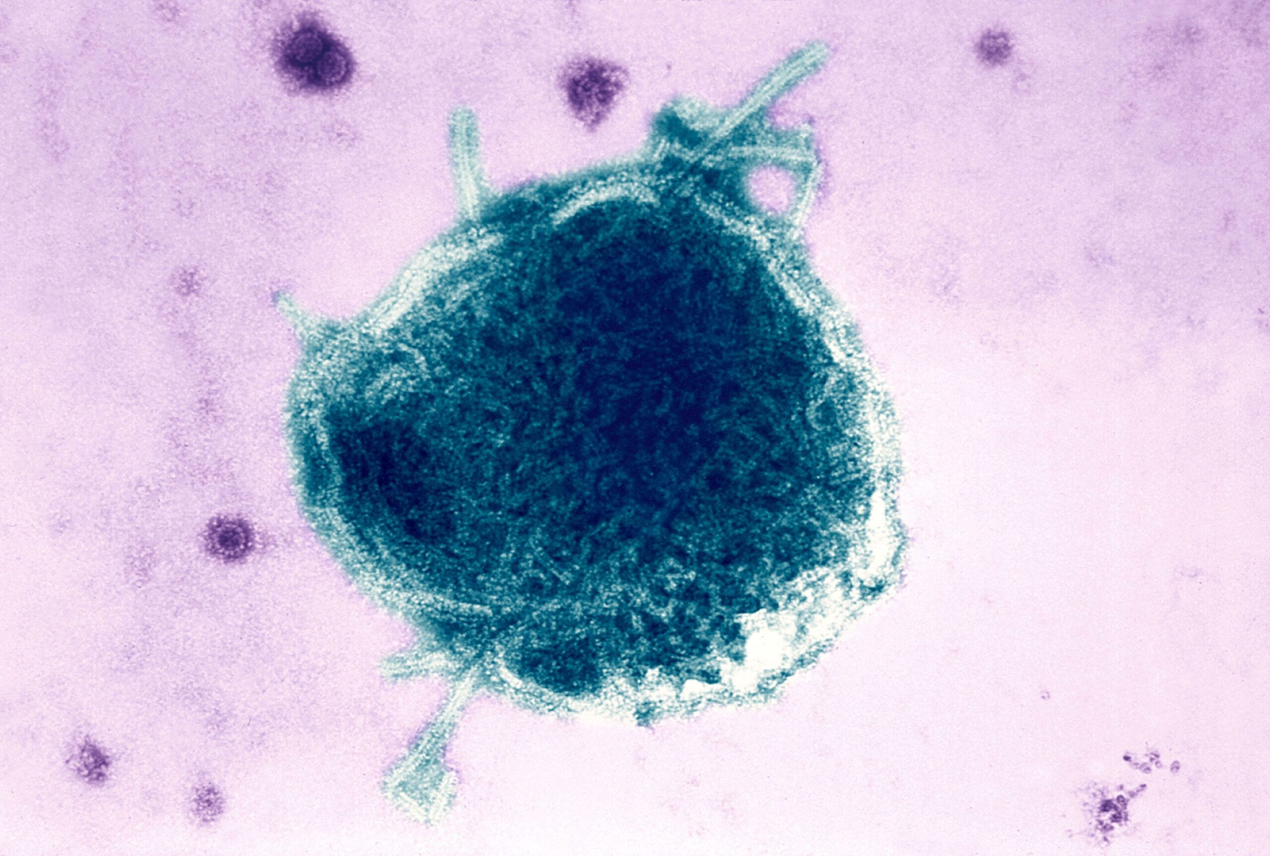 <i>BSIP/UIG via Getty Images via CNN Newsource</i><br/>Pennsylvania has reported four deaths related to measles in 2026.
