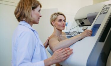 Most breast cancers aren't genetic. Here's what doctors want women to know