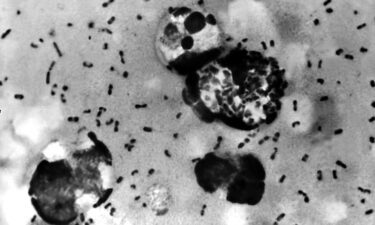 The bacteria Yersinia pestis causes plague