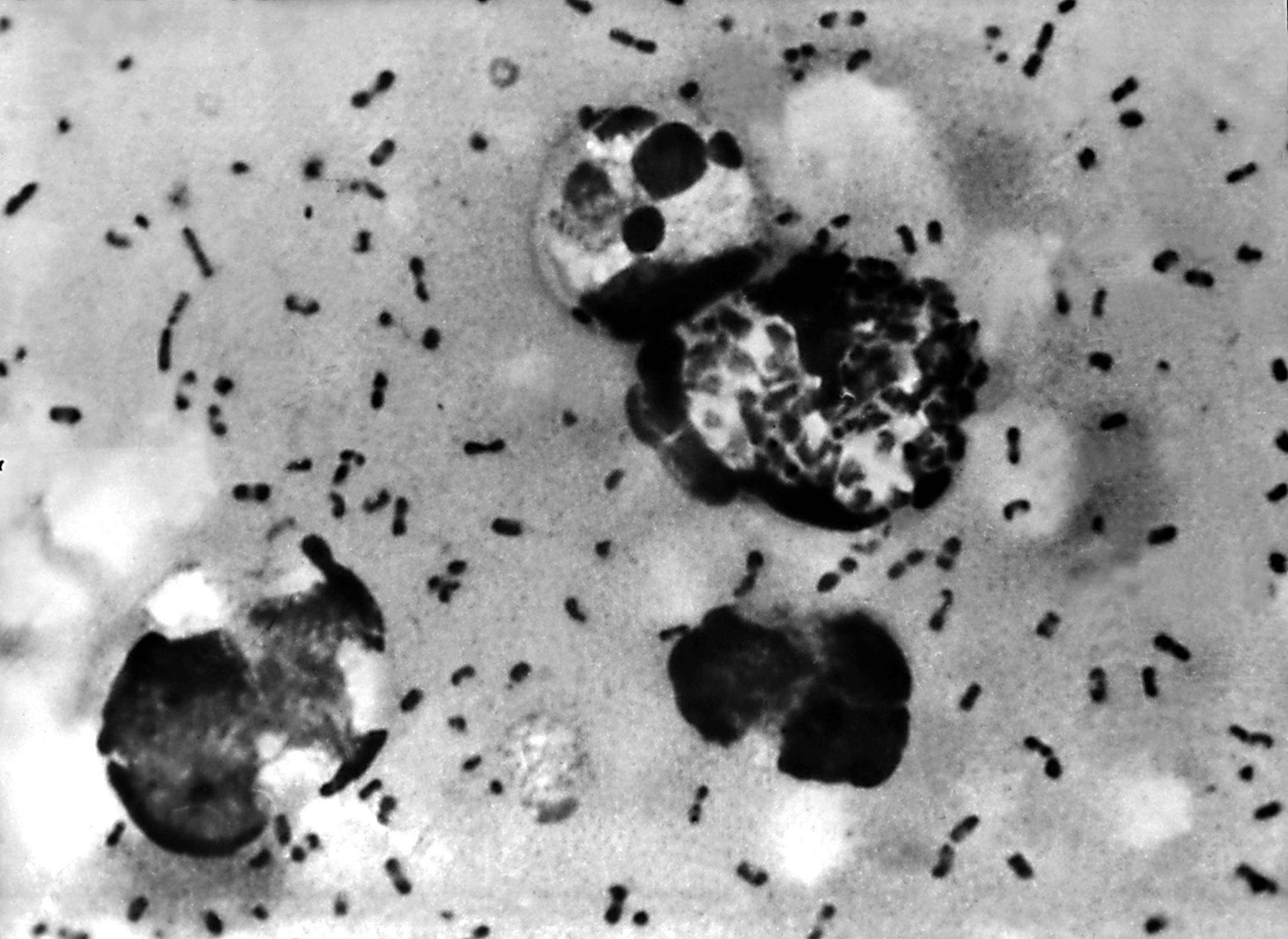 <i>Centers for Disease Control and Prevention/Getty Images via CNN Newsource</i><br/>The bacteria Yersinia pestis causes plague